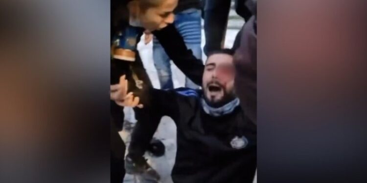 E rëndë/ I riu goditet me plumb gome nga policia, rrezikon shikimin (VIDEO)
