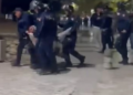 19-vjeçarit i thyen këmbën, reagon Policia e Shtetit, pezullon 4 efektivë dhe shefin e komisarit nr.1