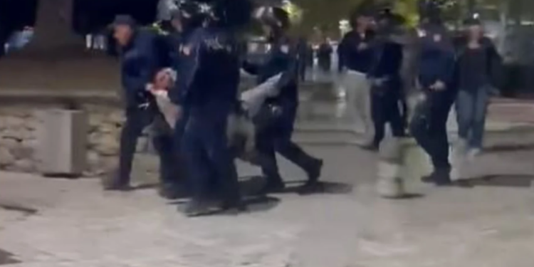 19-vjeçarit i thyen këmbën, reagon Policia e Shtetit, pezullon 4 efektivë dhe shefin e komisarit nr.1